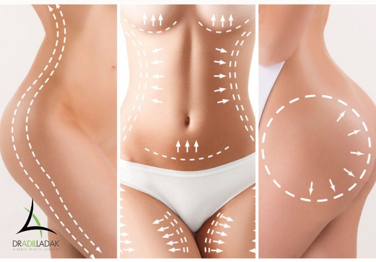 Top 5 Popular Plastic Surgery Procedures in Edmonton: Which Is Right for You? 